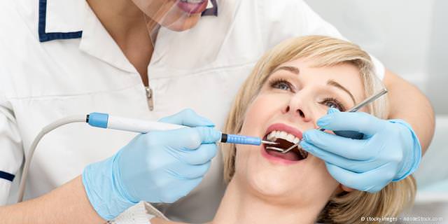 Entfernung von Zahnstein und Zahnbelägen